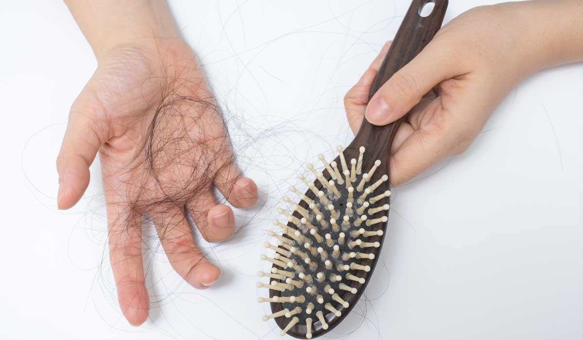 Rụng tóc, hói đầu không còn là nỗi lo với 5 phương pháp đơn giản