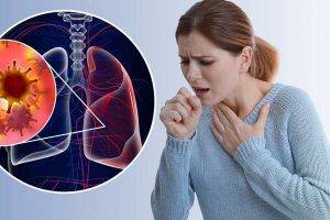 Dấu hiệu và triệu chứng bệnh ung thư phổi